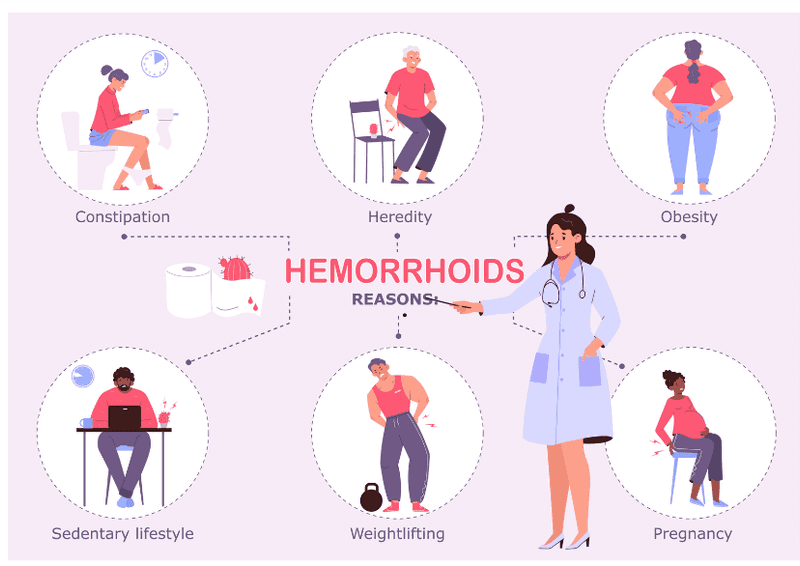 Your Guide to Understanding and Treating Hemorrhoids (Piles)